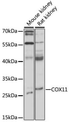 Western Blot: COX11 Antibody [NBP2-92311] - Analysis of extracts of various cell lines, using COX11 at 1:1000 dilution.Secondary antibody: HRP Goat Anti-Rabbit IgG (H+L) at 1:10000 dilution.Lysates/proteins: 25ug per lane.Blocking buffer: 3% nonfat dry milk in TBST.Detection: ECL Basic Kit .Exposure time: 30s.