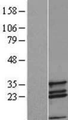 Western Blot: COX11 Overexpression Lysate (Adult Normal) [NBL1-09404] Left-Empty vector transfected control cell lysate (HEK293 cell lysate); Right -Over-expression Lysate for COX11.