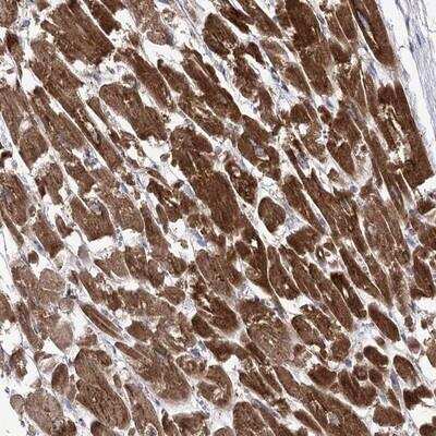 Immunohistochemistry: COX15 Antibody [NBP1-85880] - Staining of human heart muscle shows strong cytoplasmic positivity in myocytes.