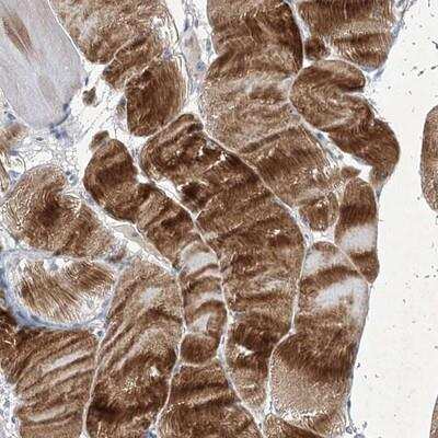 Immunohistochemistry: COX15 Antibody [NBP1-86271] - Staining of human skeletal muscle shows strong cytoplasmic positivity in myocytes.