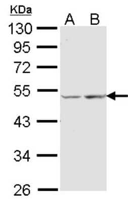 Western Blot: COX15 Antibody [NBP1-32017] - Sample (30 ug of whole cell lysate) A: A431 B: Hela 10% SDS PAGE; antibody diluted at 1:1000.