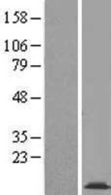Western Blot: COX16 Overexpression Lysate (Adult Normal) [NBL1-09406] Left-Empty vector transfected control cell lysate (HEK293 cell lysate); Right -Over-expression Lysate for COX16.