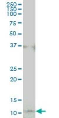Western Blot: COX17 Antibody (4G2) [NBP1-69873] - COX17 monoclonal antibody clone 4G2. Western blot of COX17 expression in IMR-32.