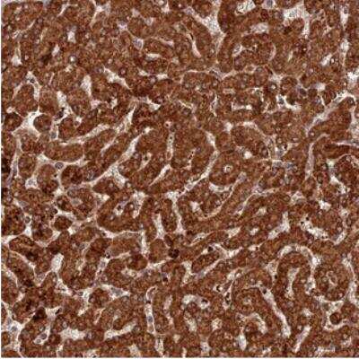 Immunohistochemistry: COX17 Antibody [NBP2-30388] - Staining of human liver shows strong cytoplasmic positivity in hepatocytes.