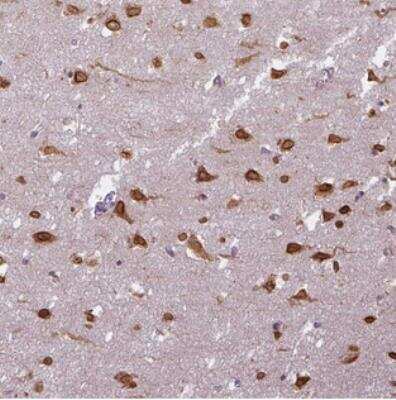 Immunohistochemistry: COX18 Antibody [NBP2-30593] - Staining of human cerebral cortex shows strong cytoplasmic and nuclear staining in neuronal cells.