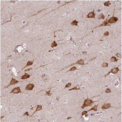 Immunohistochemistry: COX18 Antibody [NBP2-30911] - Staining of human cerebral cortex shows strong cytoplasmic positivity in neuronal cells.