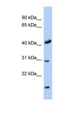 Western Blot: COX18 Antibody [NBP1-59616] - Human Muscle lysate, concentration 0.2-1 ug/ml.