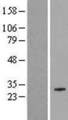 Western Blot: COX18 Overexpression Lysate (Adult Normal) [NBP2-05105] Left-Empty vector transfected control cell lysate (HEK293 cell lysate); Right -Over-expression Lysate for COX18.