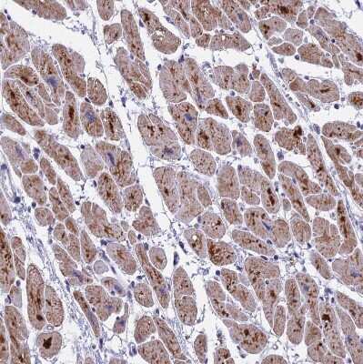 Immunohistochemistry-Paraffin: COX3 Antibody [NBP1-88063] - Staining of human heart muscle shows moderate to strong granular cytoplasmic positivity in cardiomyocytes.