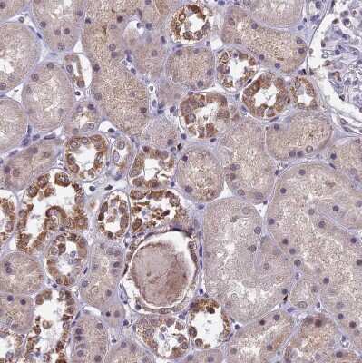 Immunohistochemistry-Paraffin: COX3 Antibody [NBP1-88063] - Staining of human kidney shows moderate to strong granular cytoplasmic positivity in cells in tubules.