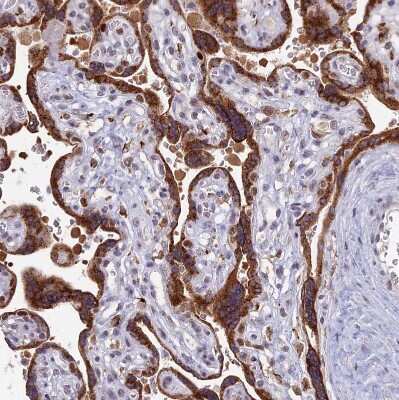 Immunohistochemistry-Paraffin: COX3 Antibody [NBP1-88063] - Staining of human placenta shows strong granular cytoplasmic positivity in trophoblastic cells.