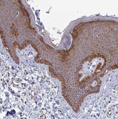Immunohistochemistry-Paraffin: COX3 Antibody [NBP1-88063] - Staining of human skin shows moderate to strong granular cytoplasmic positivity in squamous epithelial cells.