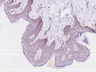 Immunohistochemistry-Paraffin: COX3 Antibody [NBP2-97594] - staining of human COX3 in human skin with rabbit polyclonal antibody at 1:200 dilution.