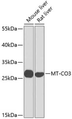 Western Blot: COX3 Antibody [NBP3-05581] - Western blot analysis of extracts of various cell lines, using COX3 antibody (NBP3-05581) at 1:1000 dilution. Secondary antibody: HRP Goat Anti-Rabbit IgG (H+L) at 1:10000 dilution. Lysates/proteins: 25ug per lane. Blocking buffer: 3% nonfat dry milk in TBST. Detection: ECL Basic Kit. Exposure time: 30s.