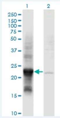 Western Blot: COX4NB Antibody (4F4) [H00010328-M01-100ug] - Analysis of COX4NB expression in transfected 293T cell line by COX4NB monoclonal antibody (M01), clone 4F4.  Lane 1: COX4NB transfected lysate (Predicted MW: 23.8 KDa). Lane 2: Non-transfected lysate.