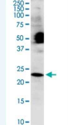 Western Blot: COX4NB Antibody (4F4) [H00010328-M01-100ug] - Monoclonal antibody (M01), clone 4F4. Western Blot analysis of COX4NB expression in HeLa.