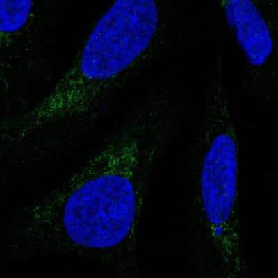 Immunocytochemistry/Immunofluorescence: COX4NB Antibody [NBP2-13864] - Staining of human cell line U-2 OS shows positivity in mitochondria.