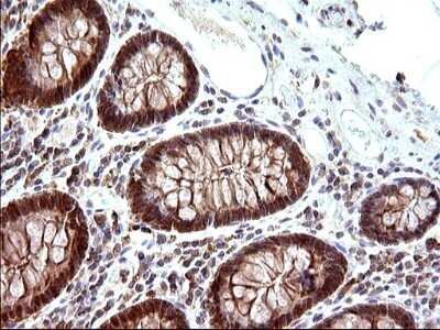 Immunohistochemistry: COX4NB Antibody (OTI1D6) - Azide and BSA Free [NBP2-71595] - Analysis of Human colon tissue. (Heat-induced epitope retrieval by 10mM citric buffer, pH6.0, 120C for 3min)