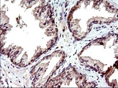 Immunohistochemistry: COX4NB Antibody (OTI1D6) - Azide and BSA Free [NBP2-71595] - Analysis of Human prostate tissue. (Heat-induced epitope retrieval by 10mM citric buffer, pH6.0, 120C for 3min)