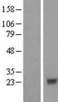 Western Blot COX4NB Overexpression Lysate
