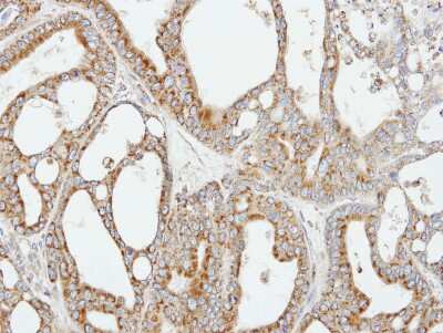 Immunohistochemistry-Paraffin: COX5b Antibody [NBP1-31303] - Paraffin-embedded H441 xenograft, using antibody at 1:100 dilution.