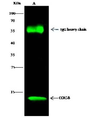 Immunoprecipitation: COX5b Antibody [NBP2-97091] - COX5b was immunoprecipitated using: Lane A: 0.5 mg HepG2 Whole Cell Lysate 2 ul anti-COX5b rabbit polyclonal antibody and 15 ul of 50 % Protein G agarose. Primary antibody: Anti-COX5b rabbit polyclonal antibody, at 1:200 dilution. Secondary antibody: Dylight 800-labeled antibody to rabbit IgG (H+L), at 1:5000 dilution. Developed using the Odyssey technique. Performed under reducing conditions. Predicted band size: 14 kDa. Observed band size: 14 kDa