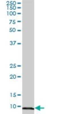 Western Blot: COX5b Antibody [H00001329-B01P] - Analysis of COX5B expression in human pancreas.