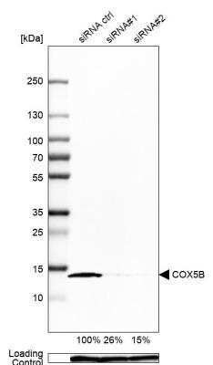 Western Blot COX5b Antibody