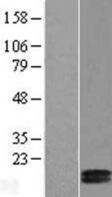 Western Blot COX5b Overexpression Lysate