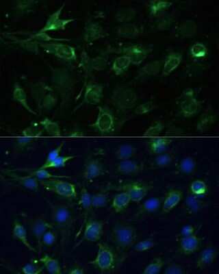 Immunocytochemistry/Immunofluorescence: COX6A1 Antibody [NBP2-92889] - Immunofluorescence analysis of C6 cells using COX6A1 Polyclonal Antibody (NBP2-92889) at dilution of 1:100 (40x lens). Blue: DAPI for nuclear staining.