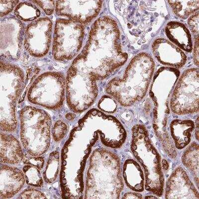 Immunohistochemistry-Paraffin: COX6A1 Antibody [NBP2-46865] - Staining of human kidney shows strong cytoplasmic positivity in renal tubules.