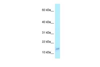 Western Blot: COX6A1 Antibody [NBP2-84721] - WB Suggested Anti-COX6A1 Antibody. Titration: 1.0 ug/ml. Positive Control: 293T Whole CellCOX6A1 is supported by BioGPS gene expression data to be expressed in HEK293T