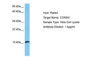 Western Blot: COX6A1 Antibody [NBP2-84722] - Host: Rabbit. Target Name: COX6A1. Sample Tissue: Human Hela Whole Cell lysates. Antibody Dilution: 1ug/ml