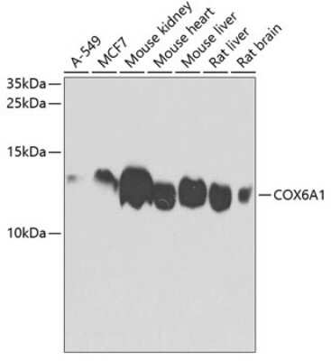 Western Blot: COX6A1 Antibody [NBP2-92889] - Analysis of extracts of various cell lines, using COX6A1 at 1:1000 dilution.Secondary antibody: HRP Goat Anti-Rabbit IgG (H+L) at 1:10000 dilution.Lysates/proteins: 25ug per lane.Blocking buffer: 3% nonfat dry milk in TBST.Detection: ECL Basic Kit .Exposure time: 60s.