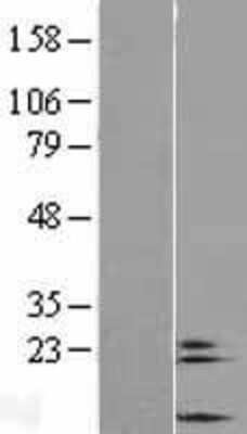 Western Blot: COX6A2 Overexpression Lysate (Adult Normal) [NBL1-09415] Left-Empty vector transfected control cell lysate (HEK293 cell lysate); Right -Over-expression Lysate for COX6A2.
