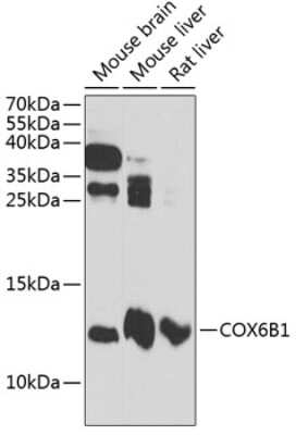 Western Blot: COX6B1 Antibody [NBP2-92703] - Analysis of extracts of various cell lines, using COX6B1 .Exposure time: 10s.