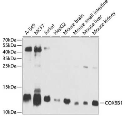 Western Blot: COX6B1 Antibody [NBP2-92771] - Analysis of extracts of various cell lines, using COX6B1 at 1:1000 dilution.Secondary antibody: HRP Goat Anti-Rabbit IgG (H+L) at 1:10000 dilution.Lysates/proteins: 25ug per lane.Blocking buffer: 3% nonfat dry milk in TBST.Detection: ECL Basic Kit .Exposure time: 1s.