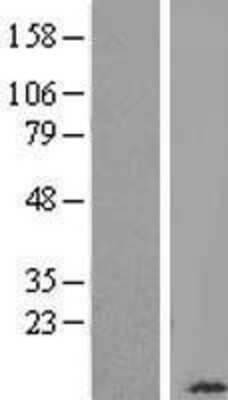Western Blot: COX6B1 Overexpression Lysate (Adult Normal) [NBL1-09416] Left-Empty vector transfected control cell lysate (HEK293 cell lysate); Right -Over-expression Lysate for COX6B1.