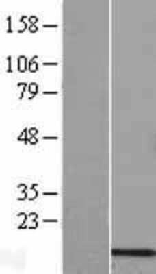 Western Blot: COX6B2 Overexpression Lysate (Adult Normal) [NBL1-09417] Left-Empty vector transfected control cell lysate (HEK293 cell lysate); Right -Over-expression Lysate for COX6B2.