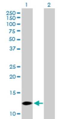 Western Blot: COX7A2L Antibody [H00009167-B01P] - Analysis of COX7A2L expression in transfected 293T cell line by COX7A2L polyclonal antibody.  Lane 1: COX7A2L transfected lysate(12.54 KDa). Lane 2: Non-transfected lysate.