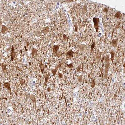 Immunohistochemistry-Paraffin COX7B Antibody