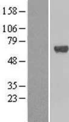 Western Blot TFCP2 Overexpression Lysate