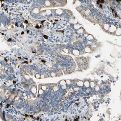 Immunohistochemistry-Paraffin CPA3 Antibody