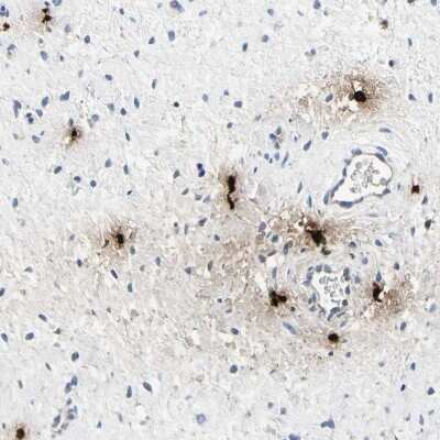 Immunohistochemistry-Paraffin CPA3 Antibody