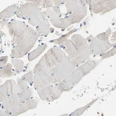 Immunohistochemistry-Paraffin CPA3 Antibody