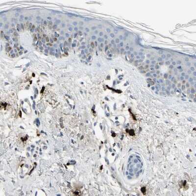 Immunohistochemistry-Paraffin: CPA3 Antibody [NBP1-86117] - Staining of human skin shows strong cytoplasmic positivity in mast cells.