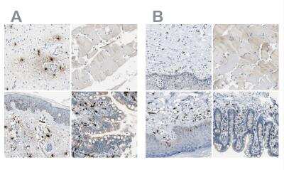 Immunohistochemistry-Paraffin: CPA3 Antibody [NBP1-86117] - Staining of human cervix, uterine, skeletal muscle, skin and small intestine using Anti-CPA3 antibody NBP1-86117 (A) shows similar protein distribution across tissues to independent antibody NBP1-86130 (B).