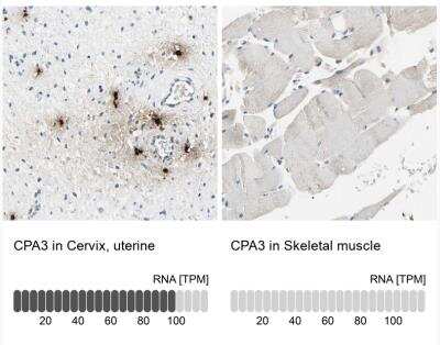 Immunohistochemistry-Paraffin: CPA3 Antibody [NBP1-86117] - Analysis in human cervix, uterine and skeletal muscle tissues. Corresponding CPA3 RNA-seq data are presented for the same tissues.