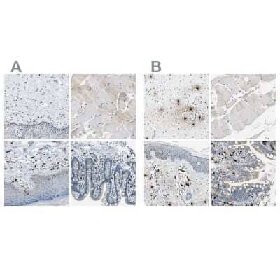 <b>Independent Antibodies Validation and Orthogonal Strategies Validation.</b>Immunohistochemistry-Paraffin: CPA3 Antibody [NBP1-86130] - Staining of human cervix, uterine, skeletal muscle, skin and small intestine using Anti-CPA3 antibody NBP1-86130 (A) shows similar protein distribution across tissues to independent antibody NBP1-86117 (B).