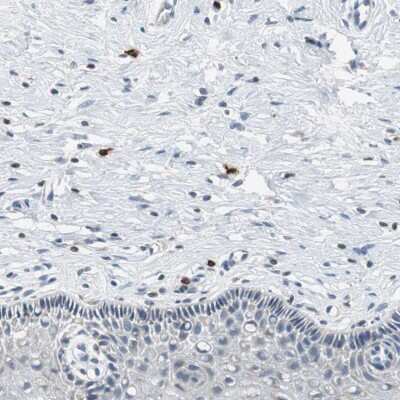 Immunohistochemistry-Paraffin: CPA3 Antibody [NBP1-86130] - Staining of human cervix, uterine shows moderate to strong cytoplasmic positivity in mast cells.